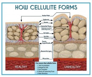 Lymphatic drainage for cellulite