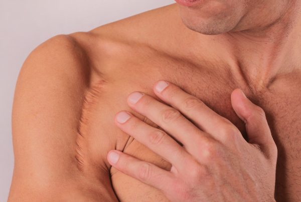 Get rid of scar tissue