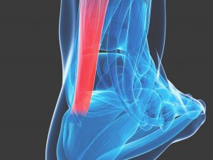 Achilles tendon pain