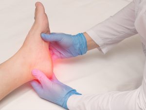 Plantar fasciitis