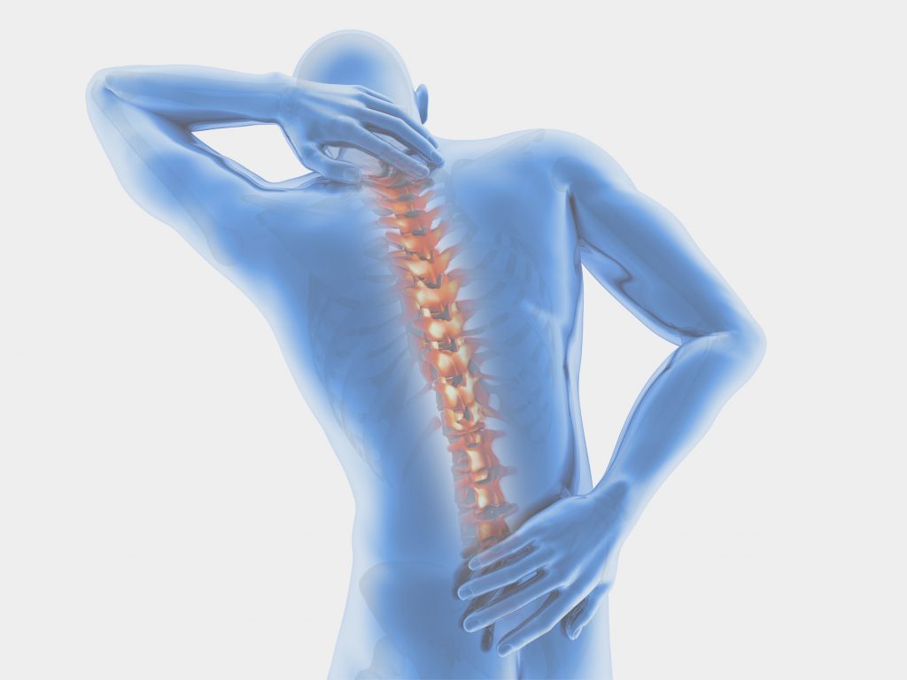 Arthritis symptoms of the spine and how to treat them Perea Clinic