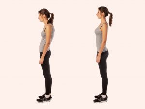 Treating poor posture