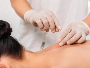 Acupuncture near angel