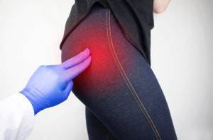 Sciatica treatment in islington