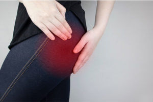 sciatica islington