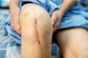 scartisuee healing in london