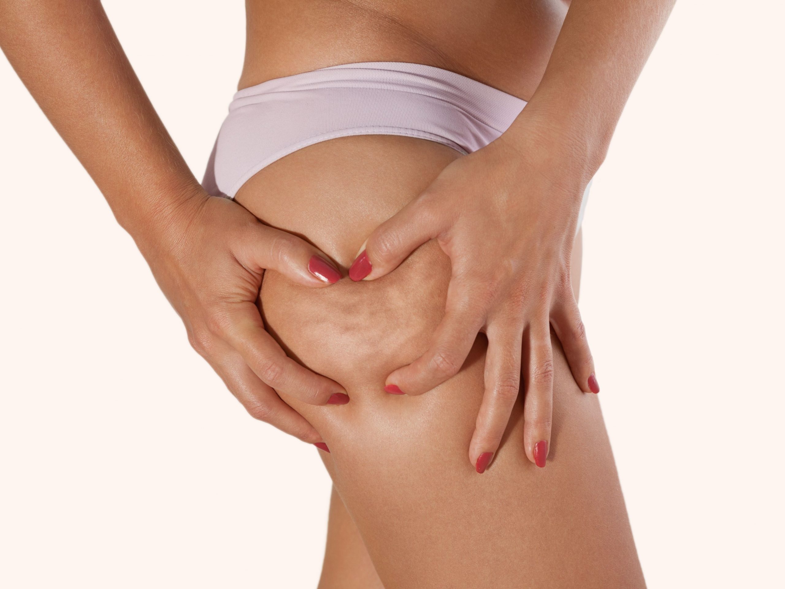 Tips to treat cellulite at home