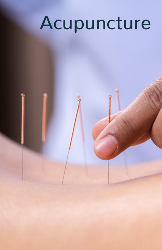 acupuncture islington london