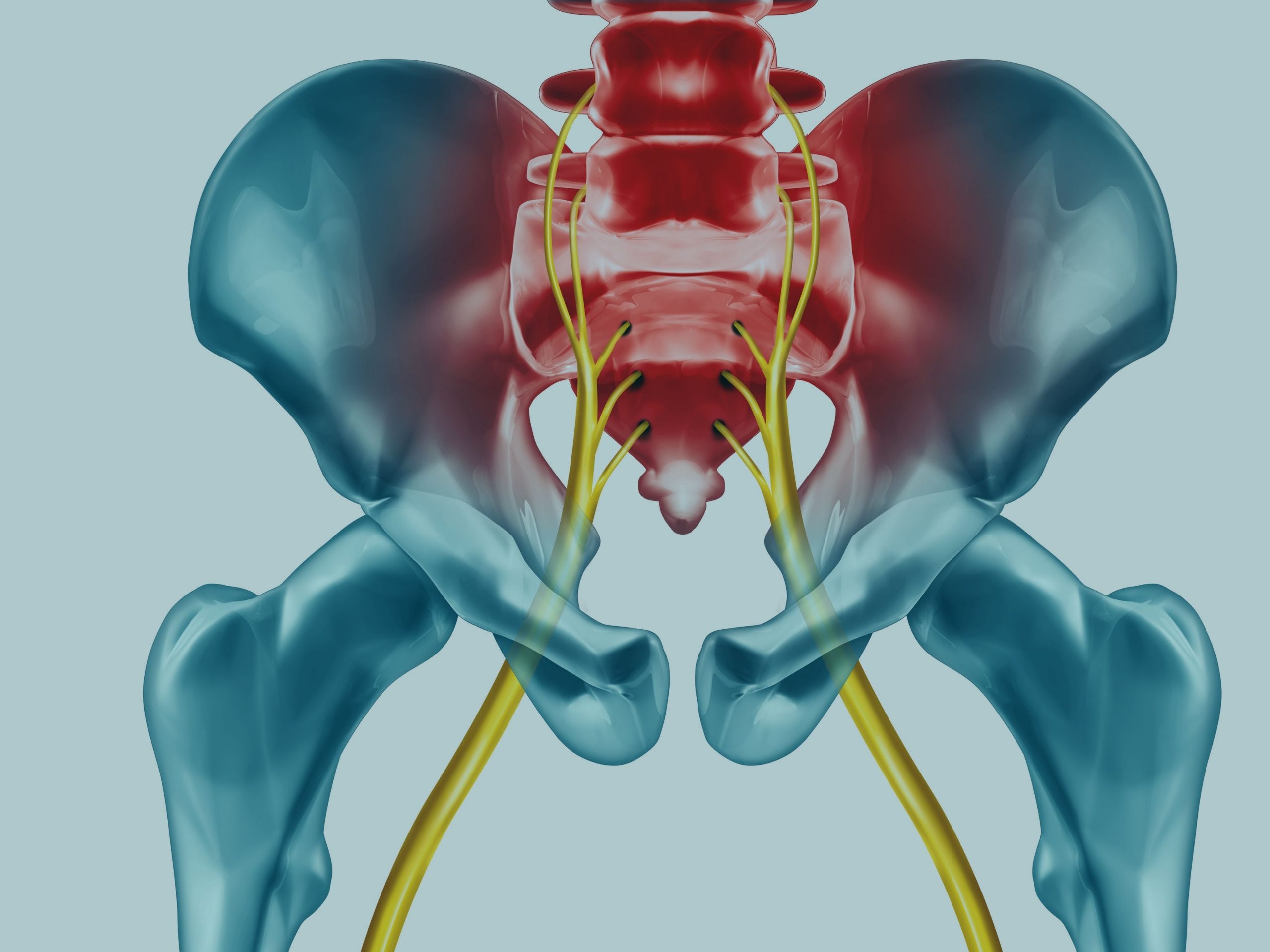 Sciatica: sciatic nerve compression-causes, symptoms and treatment