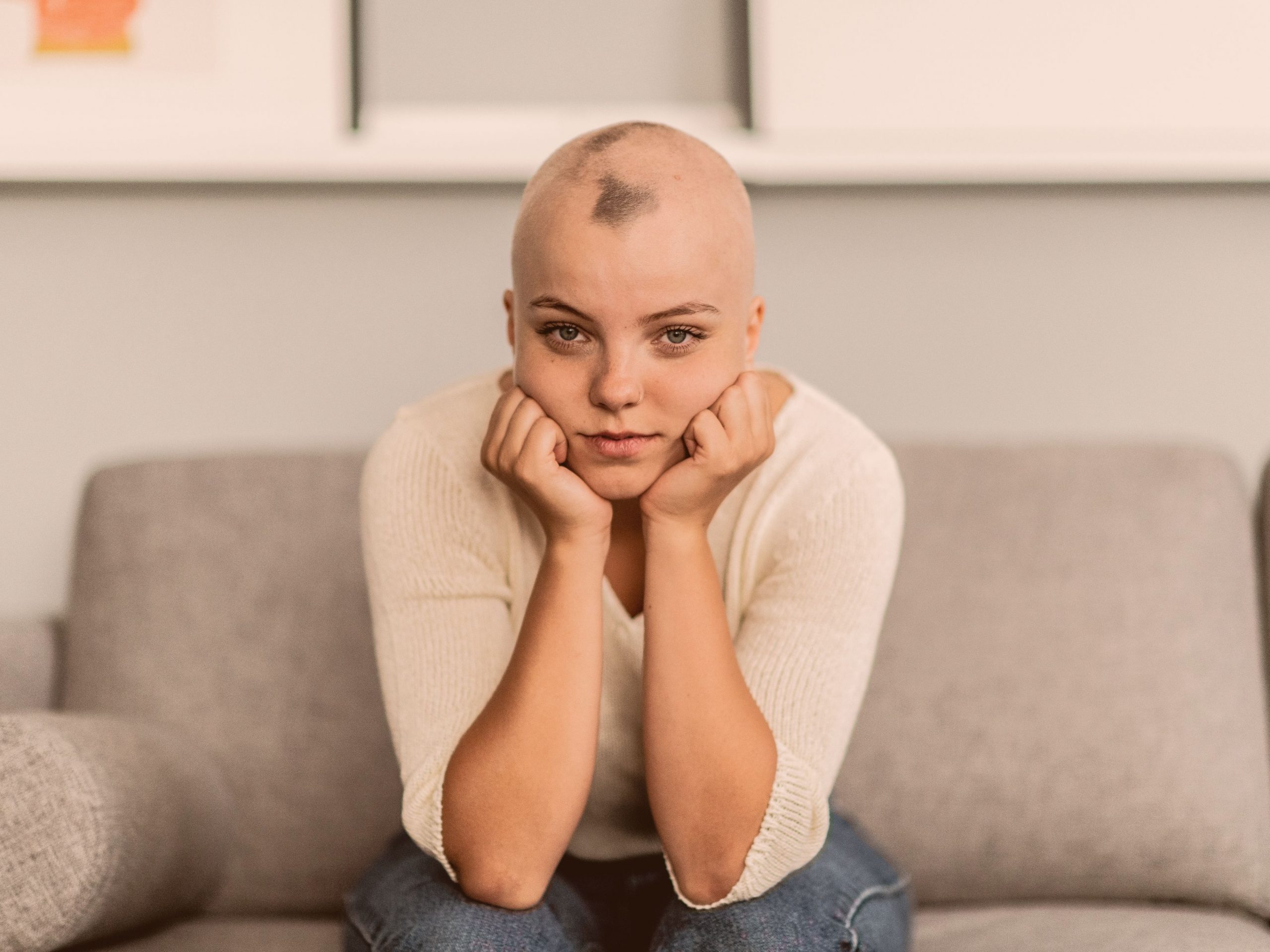 Alopecia: what Indian head massage and aromatherapy can do for you