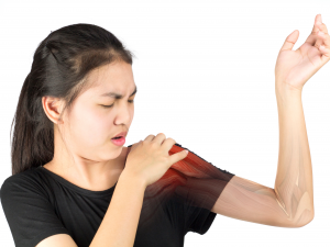 Subacromial bursitis