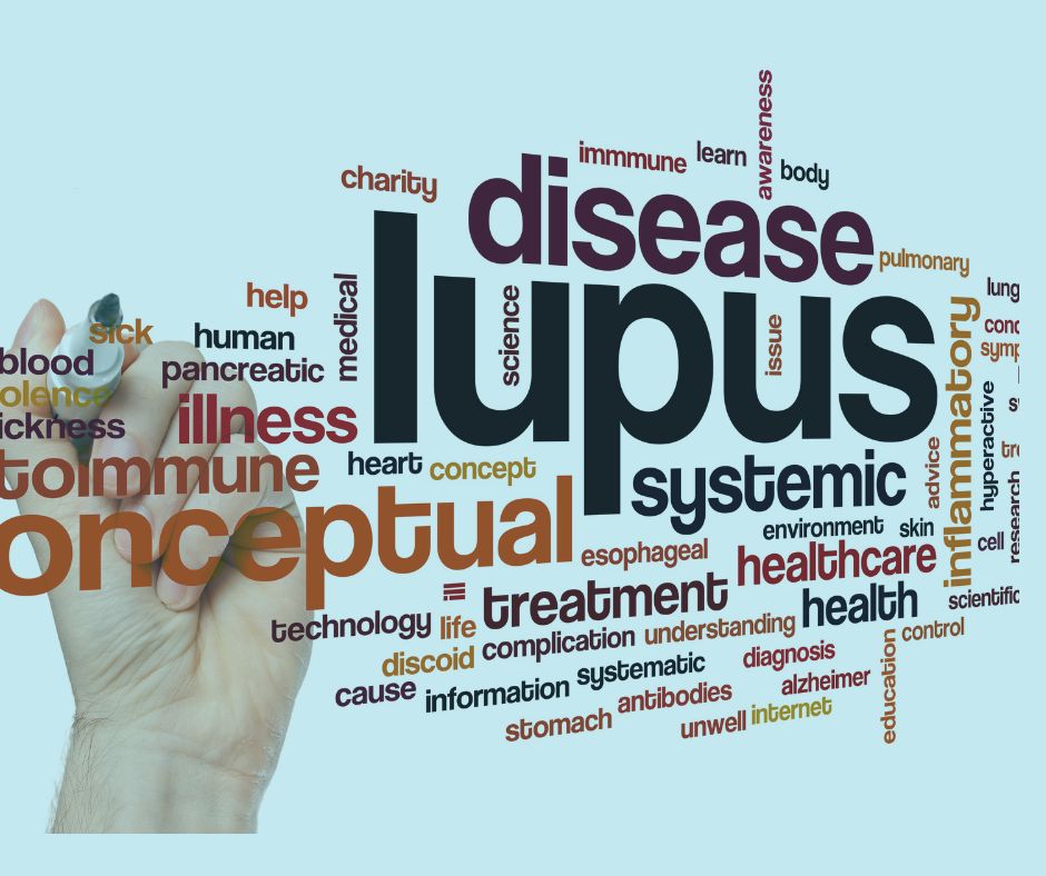 “Living with lupus: Understanding Symptoms, Diagnosis, and Treatments options” 