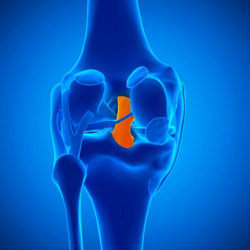 Kneecap Bursitis (carpenter’s, housemaid’s or coal miner’s knee)