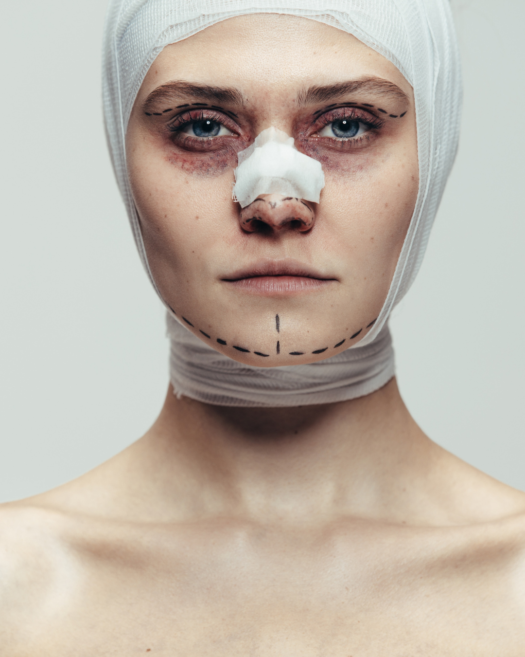 Beyond the Before and After: The Reality of Cosmetic Surgery, Healing and Mental Health
